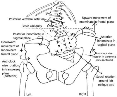 Biomechanically designed Curve Specific Corrective Exercise for Adolescent Idiopathic Scoliosis gives significant outcomes in an Adult: A case report